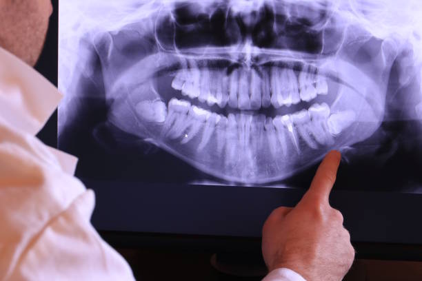 Best Emergency Dentist for Knocked-Out Tooth in North Tonawanda, NY